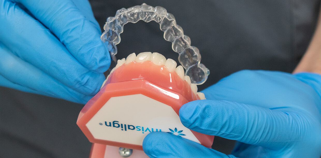 invisalign mouth mould