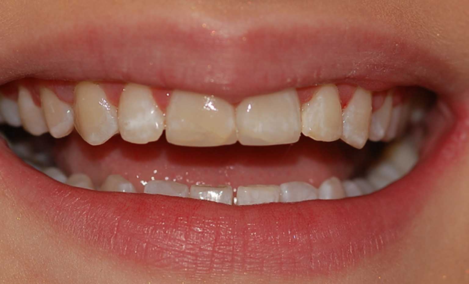 after smile treatment at Bridgford Dental Practice