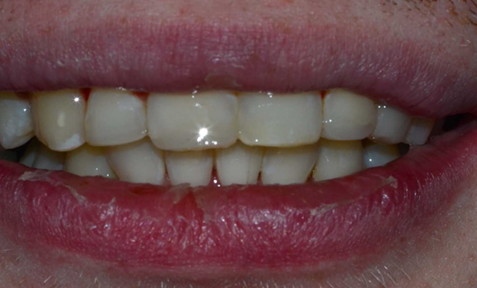 after teeth transformation in Nottingham