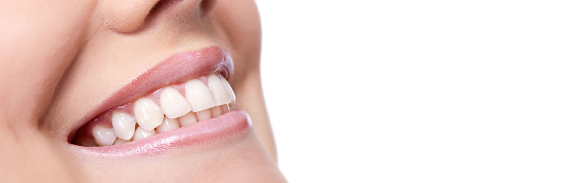 a smiling woman with straight white teeth