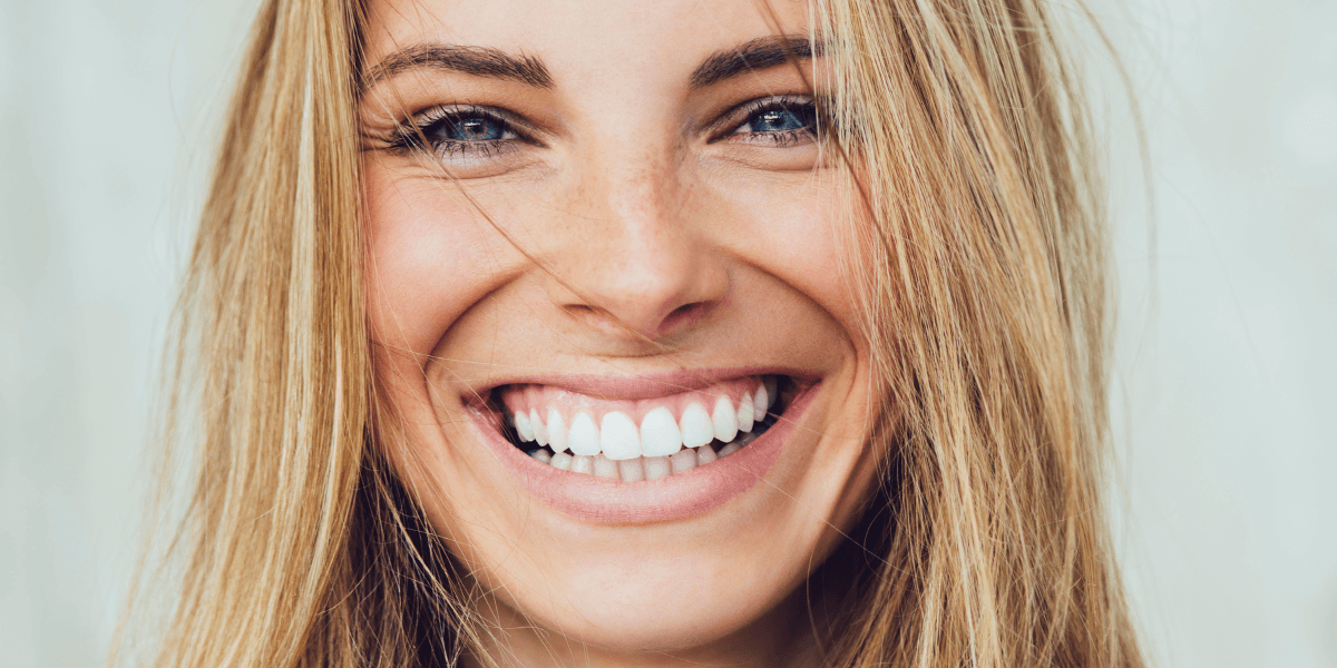 woman with bright teeth after professional whitening at bridgford dental