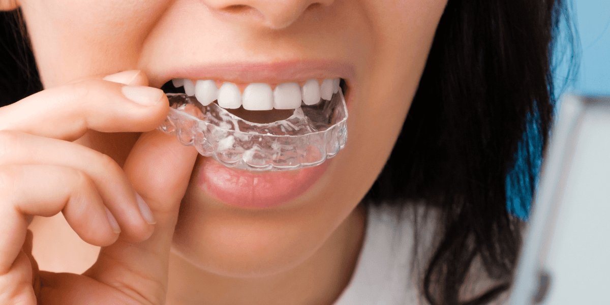 woman putting in invisalign retainer in her mouth