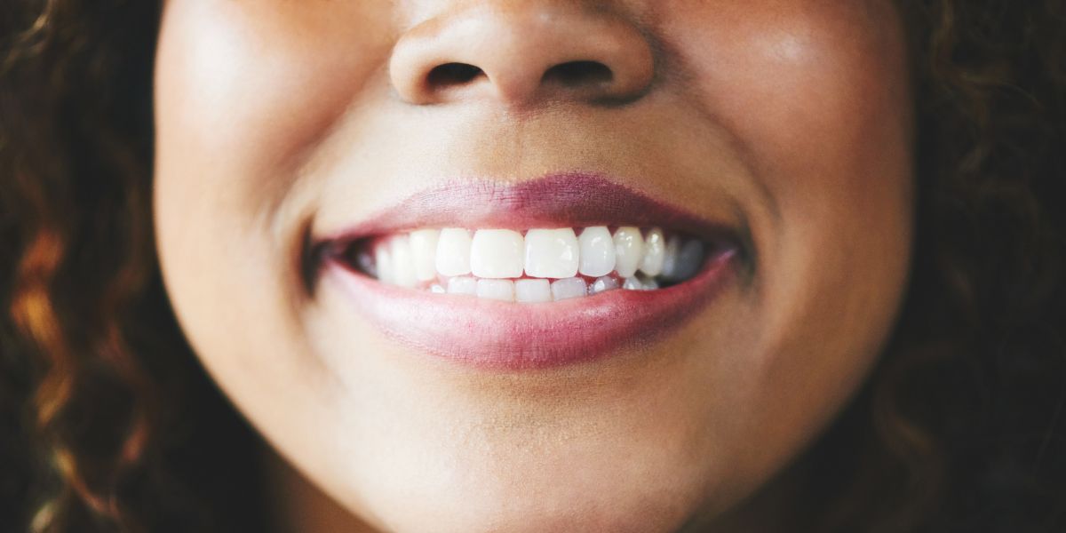 Woman smiling, showing teeth and dental implants